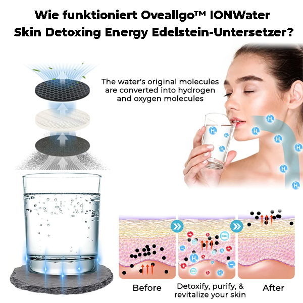 Oveallgo™ IONWater Skin Detoxing Energy Edelstein-Untersetzer