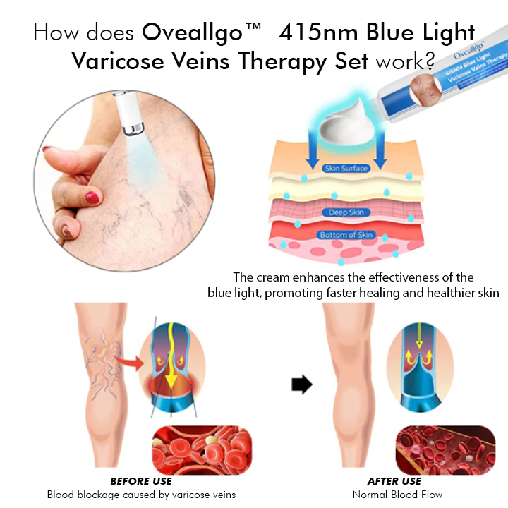 Oveallgo™ 415NM Blaulicht-Krampfadern-Therapie-Set