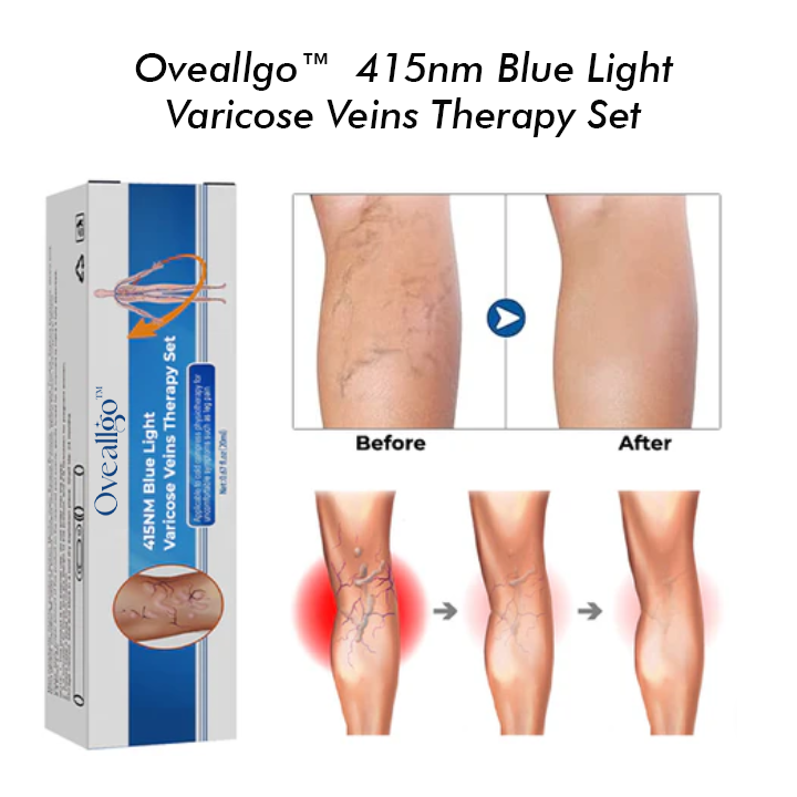 Oveallgo™ 415NM Blaulicht-Krampfadern-Therapie-Set