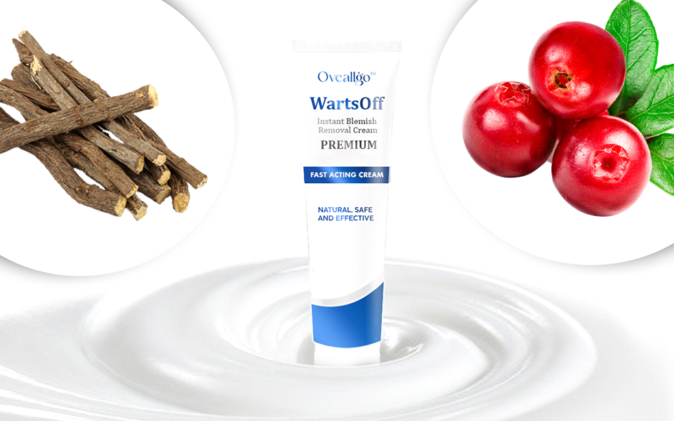 Oveallgo™ WartsOff Creme zur sofortigen Entfernung von Hautunreinheiten – PREMIUM