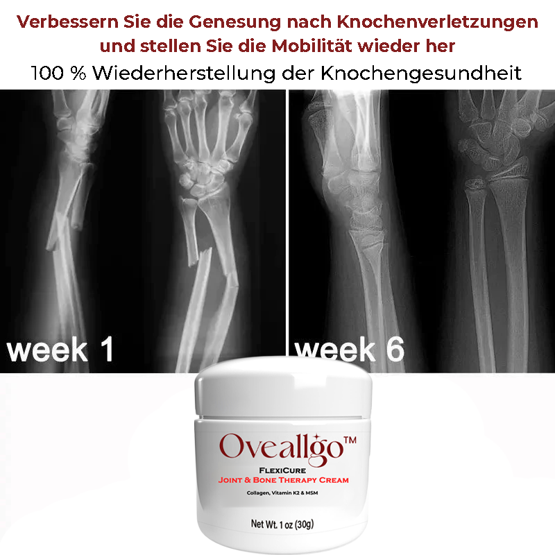 Oveallgo™ FlexiCure PURE Gelenk- und Knochentherapie-Creme