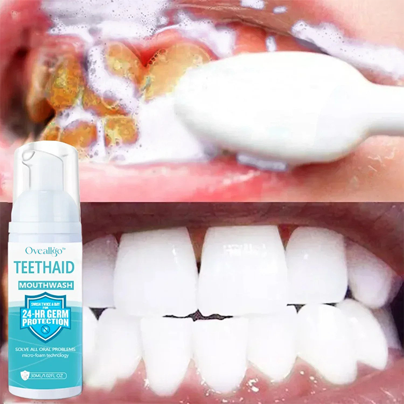 ✨Von Zahnärzten empfohlen 🦷 Oveallgo™ PRO Intensive Fleckenentfernung Mundreinigungsschaum