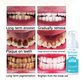 ✨Von Zahnärzten empfohlen 🦷 Oveallgo™ Intensive Fleckenentfernung Mundreinigungsschaum