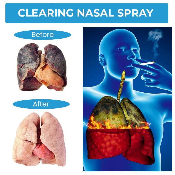 Oveallgo™ RespiCleanse Herbal Nasal Revitalizer