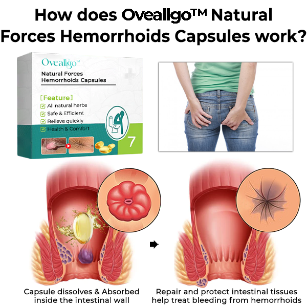 Oveallgo™ PRO Natural Forces aambeiencapsules