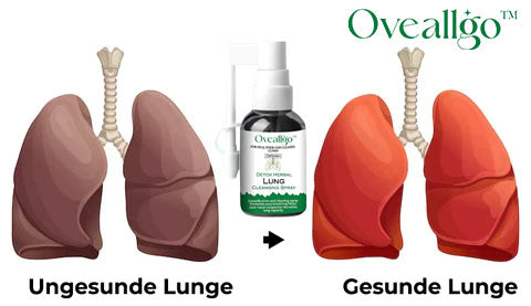Oveallgo™ PRO Detox Kräuter-Lungenreinigungsspray