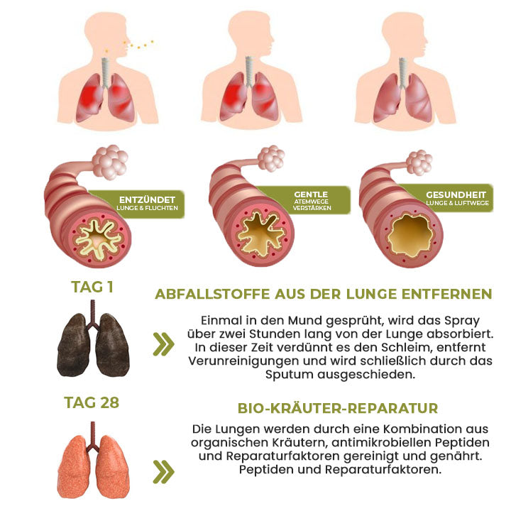 Oveallgo™ BreatheWell Natürliches Kräuterspray für Lungen- und Atemwegsunterstützung