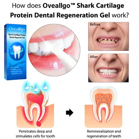 Oveallgo™ Shark Knorpel Protein Dental Regeneration Gel