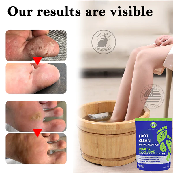 Oveallgo™ Kräuter-Entgiftungs-Reinigungs-Fußpflege-Pack
