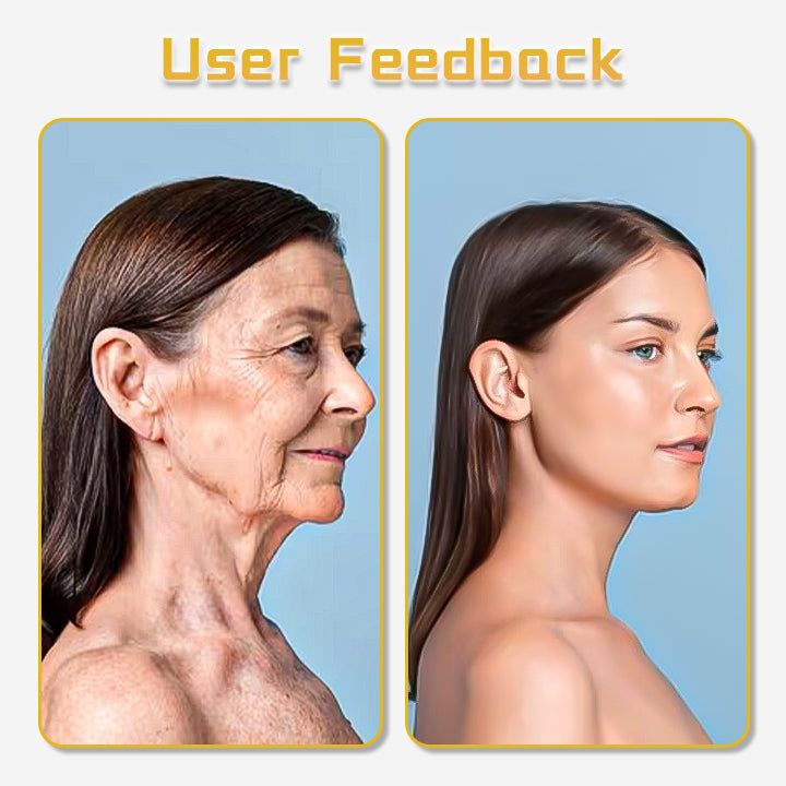 Oveallgo™ UltraRenew Ultraschall-Gesichtslifting-Gerät