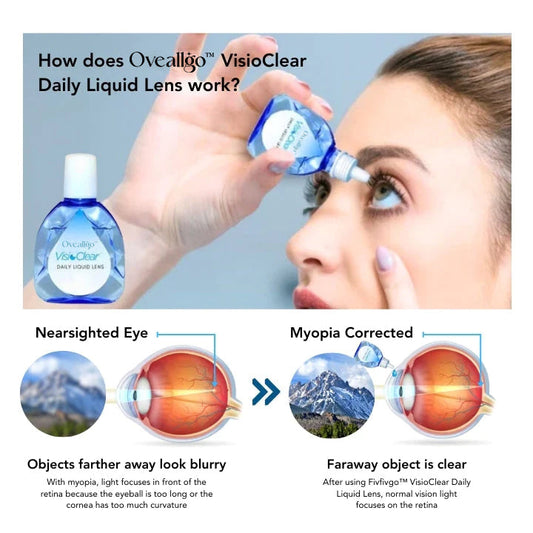 Oveallgo™ AquaVision Tageslinse
