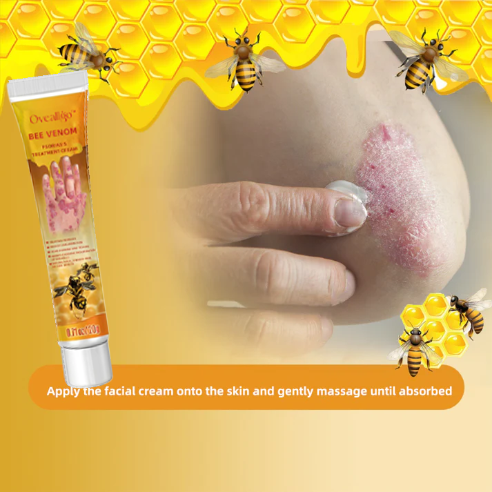 Oveallgo™ Bienen Gift Psoriasis Behandlungscreme