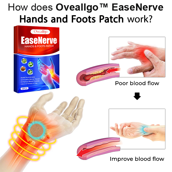 Oveallgo™ EaseNerve Pflaster für Hände und Füße
