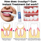 Oveallgo™ Gum Instant Behandelingsgel