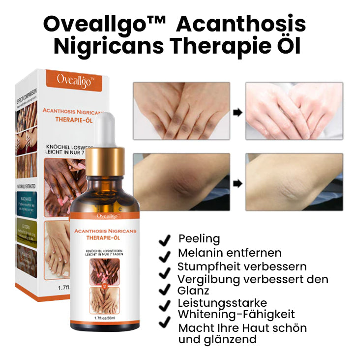 Oveallgo™ Akanthose LUX Nigricans Therapieöl