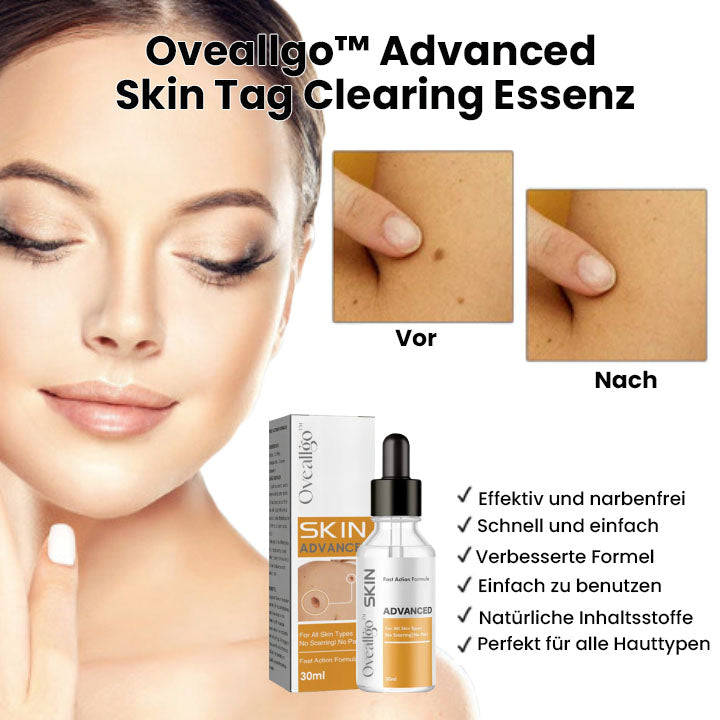 Oveallgo™ Advanced Skin Tag Clearing Essenz