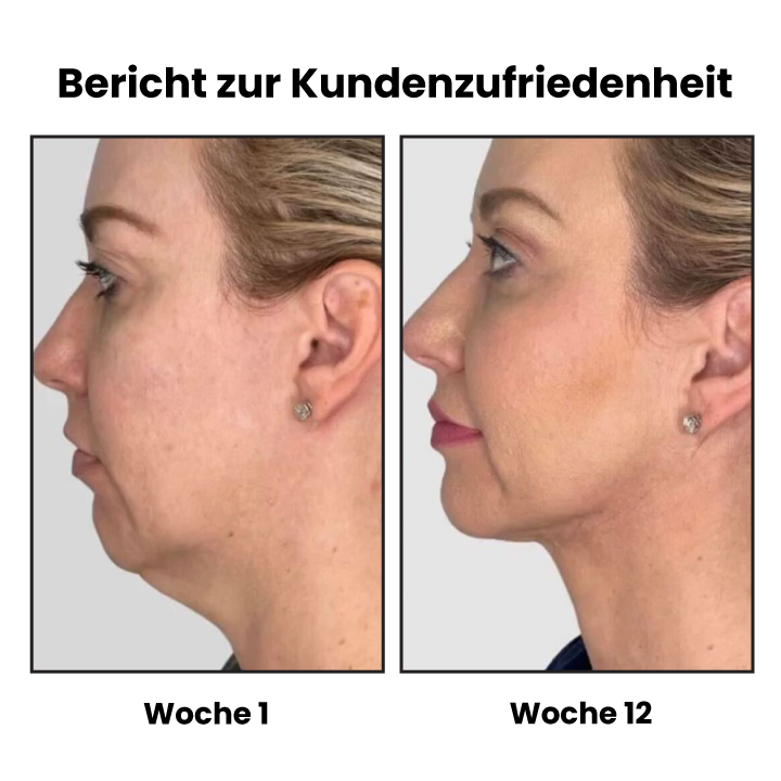 Ashy Profi Weinlese Ohrstecker Ohrringe Aurikulotherapie